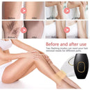 Depilador Profissional a Laser Brilhassa