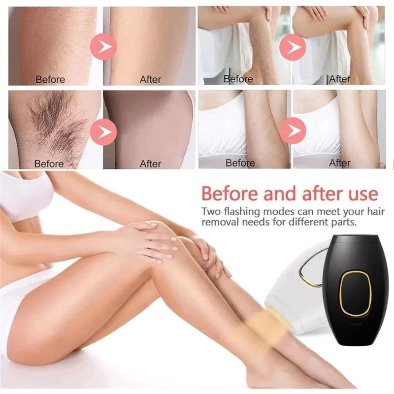 Depilador Profissional a Laser Brilhassa